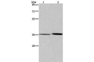 Western Blot analysis of A549 cell and Human fetal liver tissue using MAGEF1 Polyclonal Antibody at dilution of 1:300 (MAGEF1 抗体)