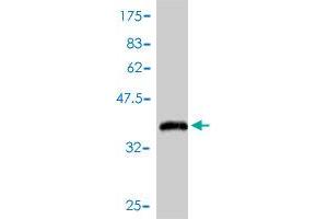 Western Blot detection against Immunogen (38. (MSMB 抗体  (AA 1-114))
