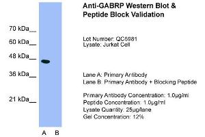 Host:  Rabbit  Target Name:  GABRP  Sample Type:  Jurkat  Lane A:  Primary Antibody  Lane B:  Primary Antibody + Blocking Peptide  Primary Antibody Concentration:  1. (GABRP 抗体  (N-Term))