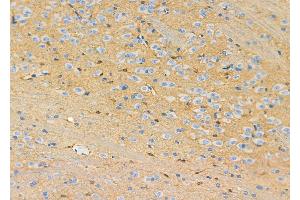 ABIN6263073 and ABIN6272517 at 1/100 staining Rat brain tissue by IHC-P. (MAGEA2 抗体  (Internal Region))