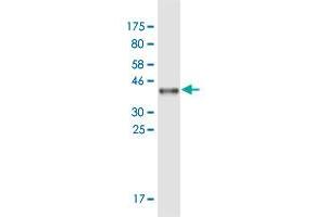 Western Blot detection against Immunogen (36. (APOB 抗体  (AA 28-127))