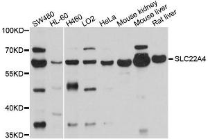 Western blot analysis of extracts of various cells, using SLC22A4 antibody. (SLC22A4 抗体)