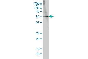 Western Blotting (WB) image for anti-GA Binding Protein Transcription Factor, alpha Subunit 60kDa (GABPA) (AA 1-101) antibody (ABIN598704) (GABPA 抗体  (AA 1-101))