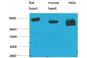 Western Blot (WB) analysis of 1) Rat Heart Tissue, 2)Mouse Heart Tissue, 3) HeLa with STAT3 Mouse Monoclonal Antibody diluted at 1:2000. (STAT3 抗体)