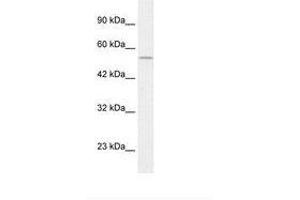 Image no. 1 for anti-Egl-9 Family Hypoxia Inducible Factor 1 (EGLN1) (C-Term) antibody (ABIN202496) (EGLN1 抗体  (C-Term))