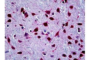 Anti-SFPQ antibody IHC of human brain, cortex. (SFPQ 抗体  (AA 269-362))
