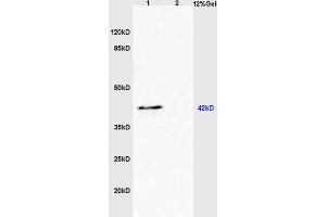 Lane 1: mouse heart lysates Lane 2: mouse liver lysates probed with Anti BAI2/Brain Specific Angiogenesis Inhibitor 2 Polyclonal Antibody, Unconjugated (ABIN872819) at 1:200 in 4 °C. (S1PR3 抗体  (AA 145-250))