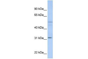 WB Suggested Anti-ZFYVE19 Antibody Titration:  0. (ZFYVE19 抗体  (C-Term))