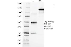 SDS-PAGE Analysis Purified AFP Mouse Monoclonal Antibody (C3).