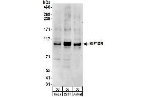 Western Blotting (WB) image for anti-Kinesin Family Member 18B (KIF18B) (AA 802-852) antibody (ABIN7453114)