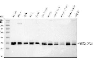 Western blot analysis of PPP2CA using anti-PPP2CA antibody (ABIN3043356).