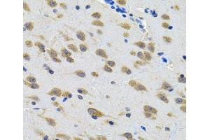 Immunohistochemistry of paraffin-embedded Rat brain using LGR6 Polyclonal Antibody at dilution of 1:100 (40x lens). (LGR6 抗体)