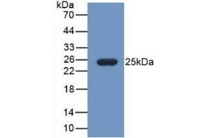 Detection of Recombinant FBLN1, Mouse using Monoclonal Antibody to Fibulin 1 (FBLN1)