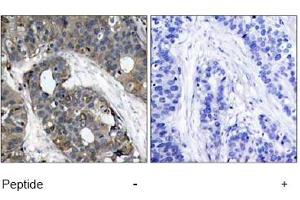 Image no. 1 for anti-Heat Shock 27kDa Protein 1 (HSPB1) (AA 80-84) antibody (ABIN197490) (HSP27 抗体  (AA 80-84))