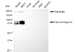 Western blotting analysis using L1 cell adhesion molecule antibody (ABIN7799219).