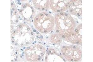 IHC-P analysis of Human Kidney Tissue, with DAB staining. (APOA1 抗体  (AA 122-267))