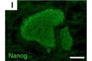 Immunofluorescence (Paraffin-embedded Sections) (IF (p)) image for anti-Nanog Homeobox (NANOG) antibody (ABIN2854880)