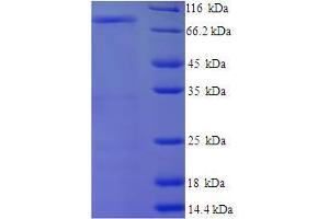 SDS-PAGE (SDS) image for CD44 (CD44) (AA 21-606), (Extracellular), (Isoform 4) protein (His-SUMO Tag) (ABIN5709235)