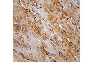 LC3II antibody immunohistochemistry analysis in formalin fixed and paraffin embedded human skeletal muscle. (LC3B 抗体  (AA 74-106))