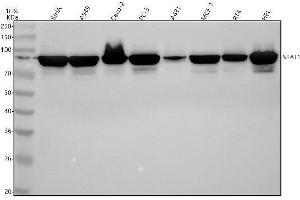 Western blot analysis of STAT1 using anti-STAT1 antibody (ABIN7606383).