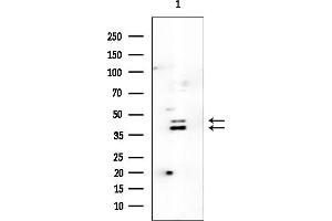 Western blot analysis of lysates from EC304 cells, using MYCL Mouse Monoclonal Antibody at 1/1000 dilution.