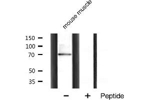 Western blot analysis of p70 S6 Kinase expression in mouse muscle tissue lysates,The lane on the right is treated with the antigen-specific peptide. (RPS6KB1 抗体  (Internal Region))