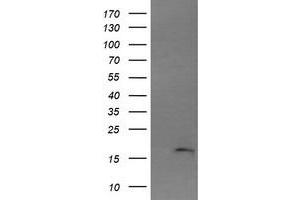Image no. 1 for anti-Cancer/testis Antigen 1B (CTAG1B) antibody (ABIN1499900) (CTAG1B 抗体)