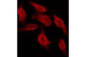 ABIN6267001 staining MCF7 by IF/ICC. (Bcl-2 抗体  (Internal Region))
