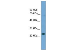 WB Suggested Anti-Ascl3 Antibody Titration: 0. (ASCL3 抗体  (Middle Region))