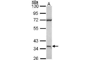 WB Image Sample (30 ug of whole cell lysate) A: Raji 10% SDS PAGE CD1D antibody antibody diluted at 1:1000 (CD1d 抗体)