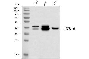 Western blot analysis of RDH10 using anti-RDH10 antibody (ABIN7599290).