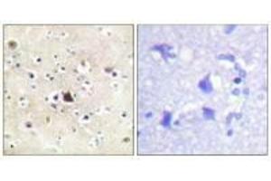 Immunohistochemical analysis of paraffin-embedded human brain tissue using GR (Ab-226) antibody. (Glucocorticoid Receptor 抗体  (Ser226, Ser234, Ser246))