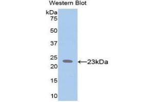 Western Blotting (WB) image for anti-Elastin (ELN) (AA 392-645) antibody (ABIN3201590) (Elastin 抗体  (AA 392-645))