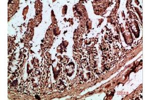 Immunohistochemical analysis of paraffin-embedded human-colon, antibody was diluted at 1:200 (IL17C 抗体  (AA 81-130))