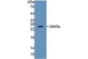 Detection of Recombinant LYPLA2, Human using Polyclonal Antibody to Lysophospholipase II (LYPLA2) (LYPLA2 抗体  (AA 1-196))