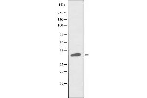 Western blot analysis of extracts from COLO cells, using PHCA antibody. (ACER3 抗体  (Internal Region))