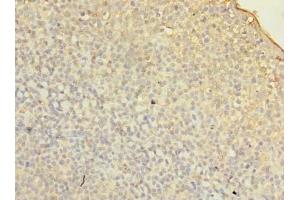 Immunohistochemistry of paraffin-embedded human tonsil tissue using ABIN7153114 at dilution of 1:100 (Formin-Like 1 抗体  (AA 207-457))
