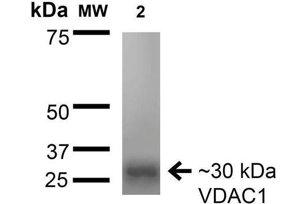 VDAC1 抗体  (AA 1-283) (Biotin)
