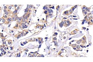 Detection of MMP7 in Human Mammary gland Tissue using Polyclonal Antibody to Matrix Metalloproteinase 7 (MMP7) (MMP7 抗体  (AA 1-267))