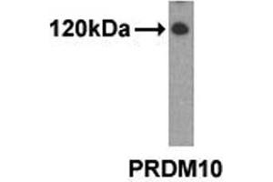 Western analysis of extracts from 293 cells using PRDM10 antibody. (PRDM10 抗体  (N-Term))
