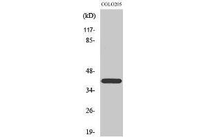 Western Blotting (WB) image for anti-Family with Sequence Similarity 203, Member B (FAM203B) (Internal Region) antibody (ABIN3183554) (FAM203B 抗体  (Internal Region))