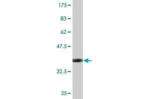 Western Blot detection against Immunogen (36. (SECISBP2 抗体  (AA 106-205))