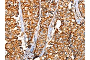 Immunohistochemistry (IHC) image for anti-Solute Carrier Family 25 (Mitochondrial Carrier, Phosphate Carrier), Member 3 (SLC25A3) antibody (ABIN7192442)