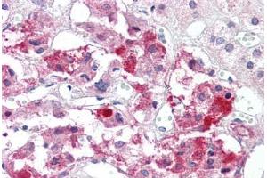 Anti-BAD antibody IHC staining of human adrenal. (BAD 抗体  (AA 119-168))