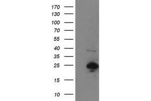 Image no. 1 for anti-Synovial Sarcoma, X Breakpoint 1 (SSX1) antibody (ABIN1501160) (SSX1 抗体)