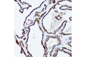 Immunohistochemistry (IHC) image for anti-Keratin 19 (KRT19) (AA 241-400) antibody (ABIN3020779)