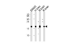Western blot analysis of lysates from SW480 cell line, human brain, mouse brain and rat brain tissue lysate(from left to right), using VILIP1 Antibody at 1:1000 at each lane. (VSNL1 抗体  (C-Term))