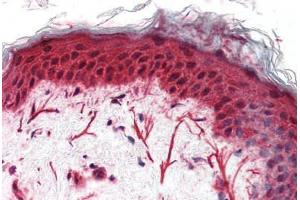 Anti-FZD3 / Frizzled 3 antibody  ABIN1048620 IHC staining of human skin. (FZD3 抗体  (N-Term))