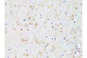 Immunohistochemistry of paraffin-embedded rat brain using RBFOX3 antibody (ABIN1874561) at dilution of 1:100 (40x lens). (NeuN 抗体)