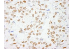 Immunohistochemistry (IHC) image for anti-C-terminal Binding Protein 1 (CTBP1) (AA 400-440) antibody (ABIN7448499)